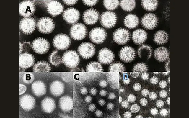 From the Oceans to Your Gut – AI Can Help Us Track What Viruses Are Up to - News Karnataka