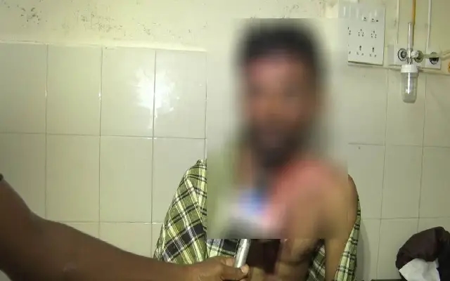 Violent Attack in Madikeri Leaves Young Man Severely Injured - News Karnataka