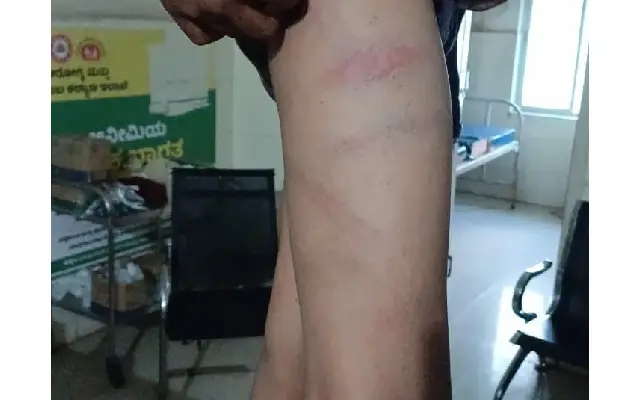 Bidar Teacher Thrash Student Badly for Not Completing Homework - News Karnataka