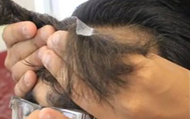 Natural Hair Fixing Center: Non-Surgical Solutions for Hair Loss - News Karnataka