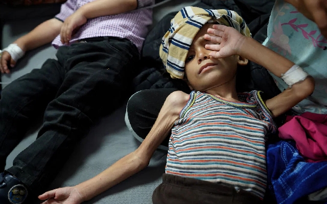 Gaza Mothers Struggle to Find Milk for Malnourished Kids - News Karnataka