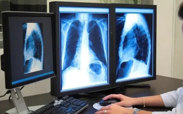 Radiologist Fined Rs 30 Lakh for False Scan Report of Pregnant Woman - News Karnataka