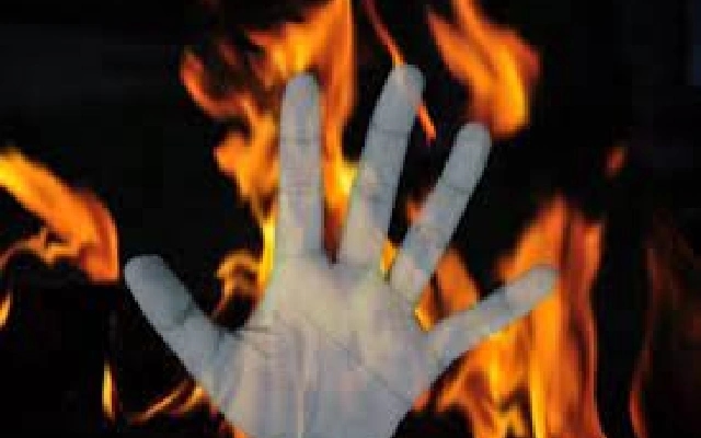 Woman Dies from Burn Injuries After Alleged Attack by Brother-in-Law in Sullia - News Karnataka