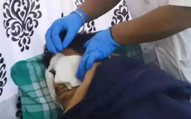 Bengaluru Faces 154 Firecracker-Related Eye Injuries During Deepavali - News Karnataka