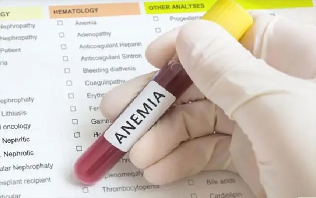 Anaemia Affects Over 4,000 Students in Dakshina Kannada, Health Initiative Underway - News Karnataka