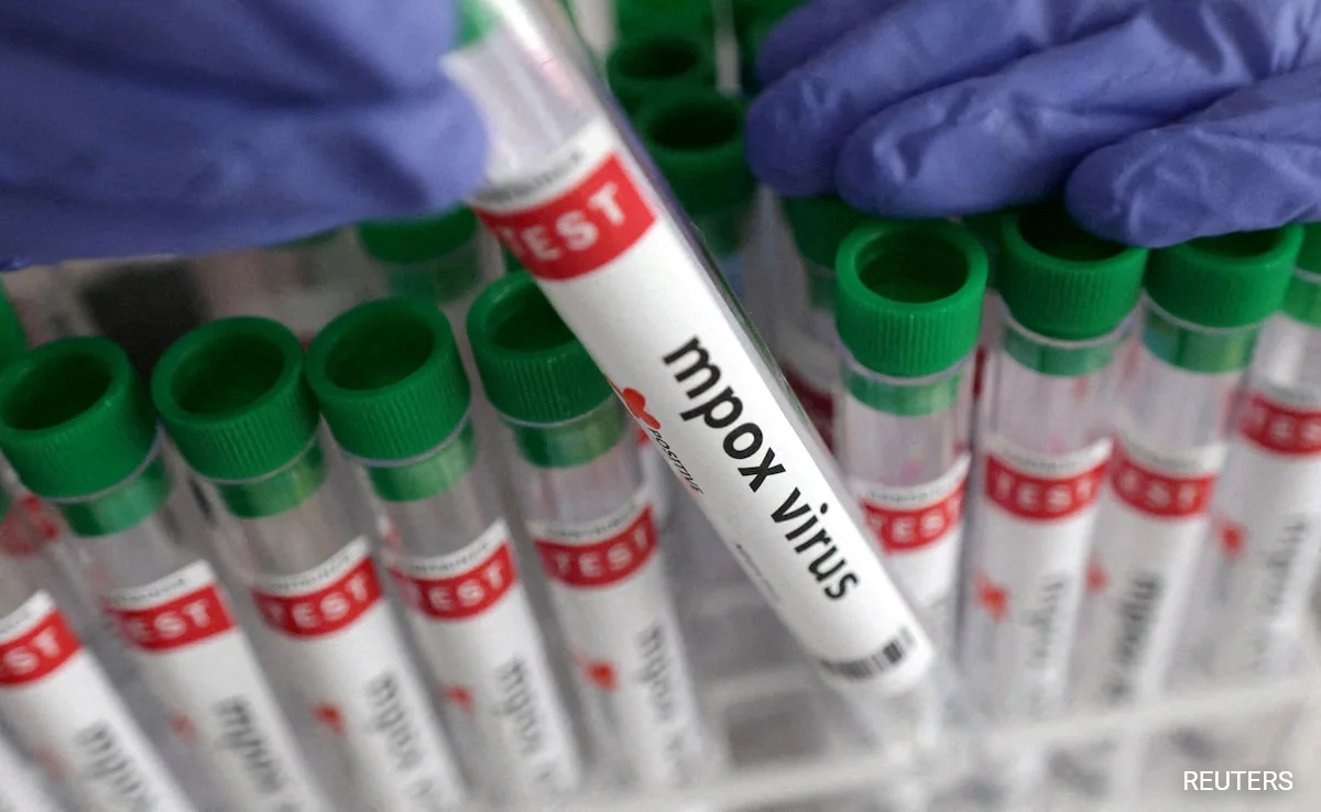 First suspected case of Mpox reported in Bengaluru this year - News Karnataka