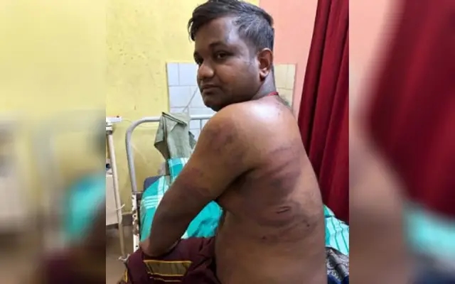 Yakshagana Artiste Assaulted Over Loan Dispute in Udupi - News Karnataka