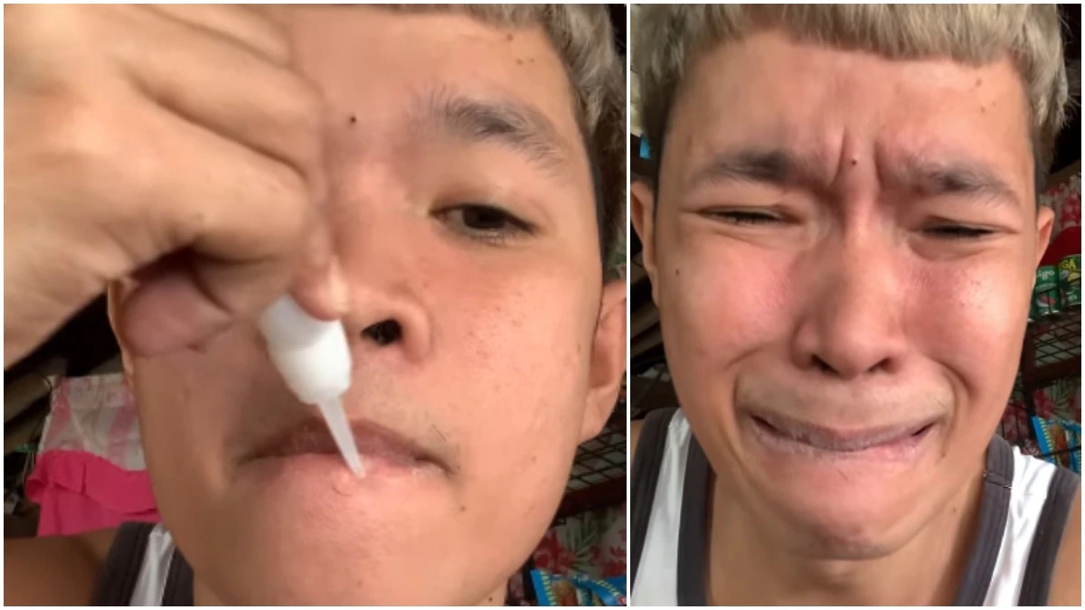 Viral Prank Gone Wrong: Man's Superglue Stunt Raises Serious Concerns - News Karnataka