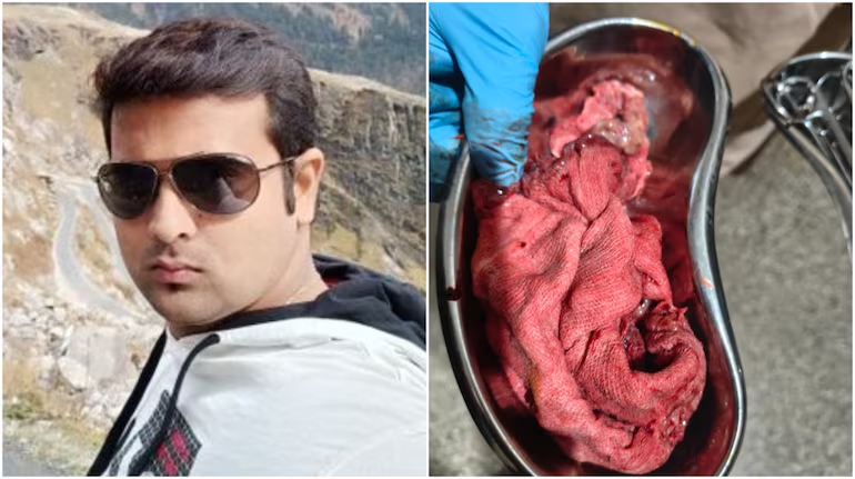 Medical Negligence After Surgical Mop Left Inside Wife's Stomach Post-C-Section - News Karnataka