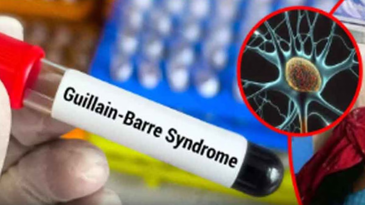 Third Guillain-Barré Syndrome death in Nagpur, cases continue to rise - News Karnataka