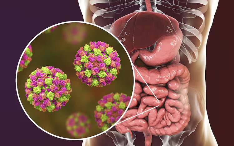 New virus in Canada, Norovirus causes vomiting in people - News Karnataka
