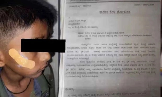 Nurse uses Fevi Kwik instead of stitches, to prevent leaving a scar - News Karnataka
