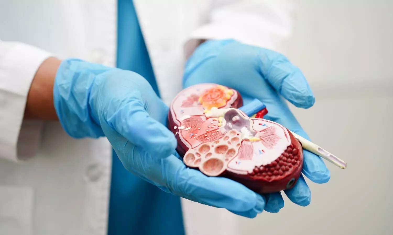 Patient with rare Bombay blood group finally finds donor for kidney transplant - News Karnataka