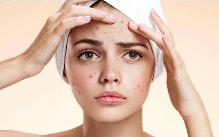 Why you need to ask a doctor before following viral beauty trends - News Karnataka