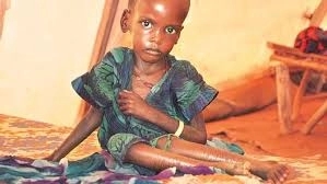 Underweight: A Hidden Health Crisis and Strategies for Addressing Malnutrition - News Karnataka