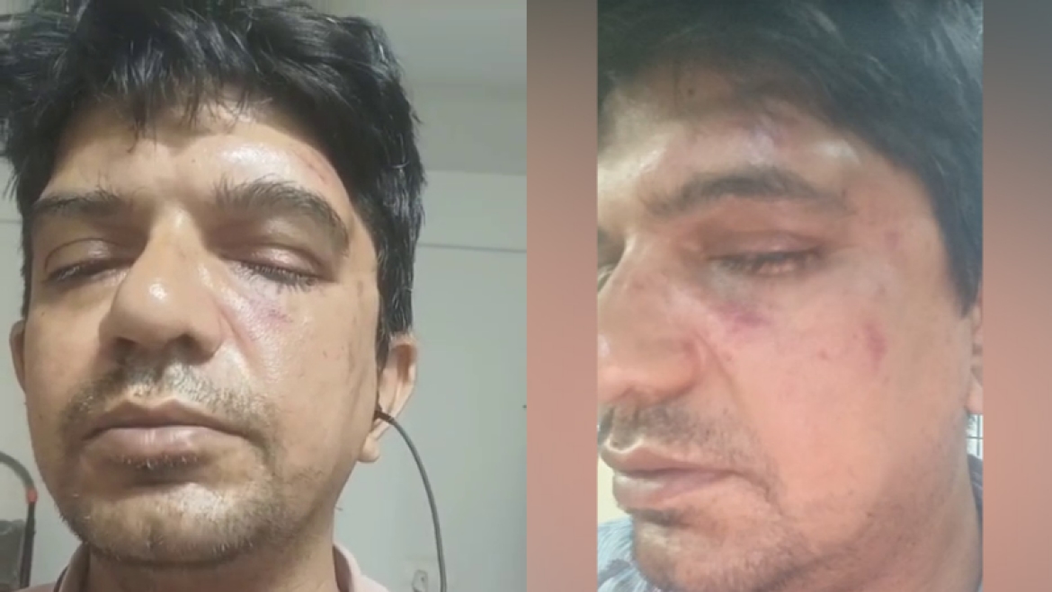 Bengaluru professor brutally thrashed for opposing roadside littering - News Karnataka