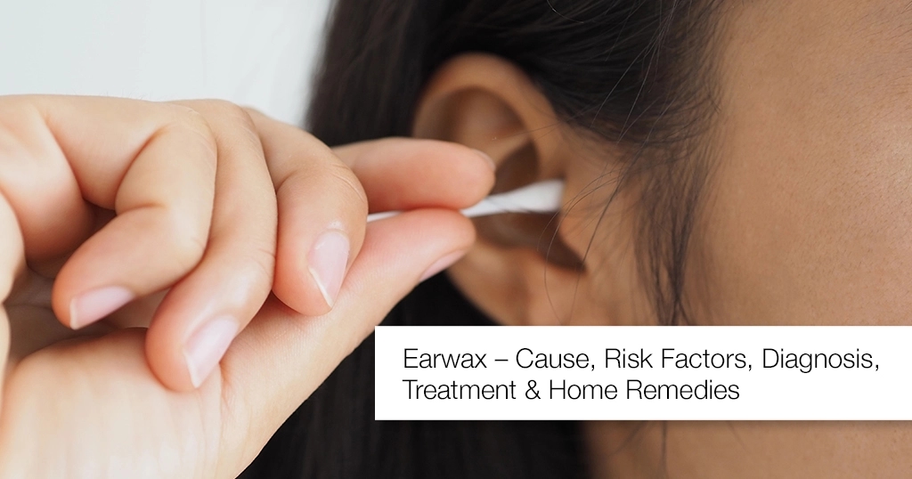 Earwax: A potential goldmine for diagnosing diseases - News Karnataka