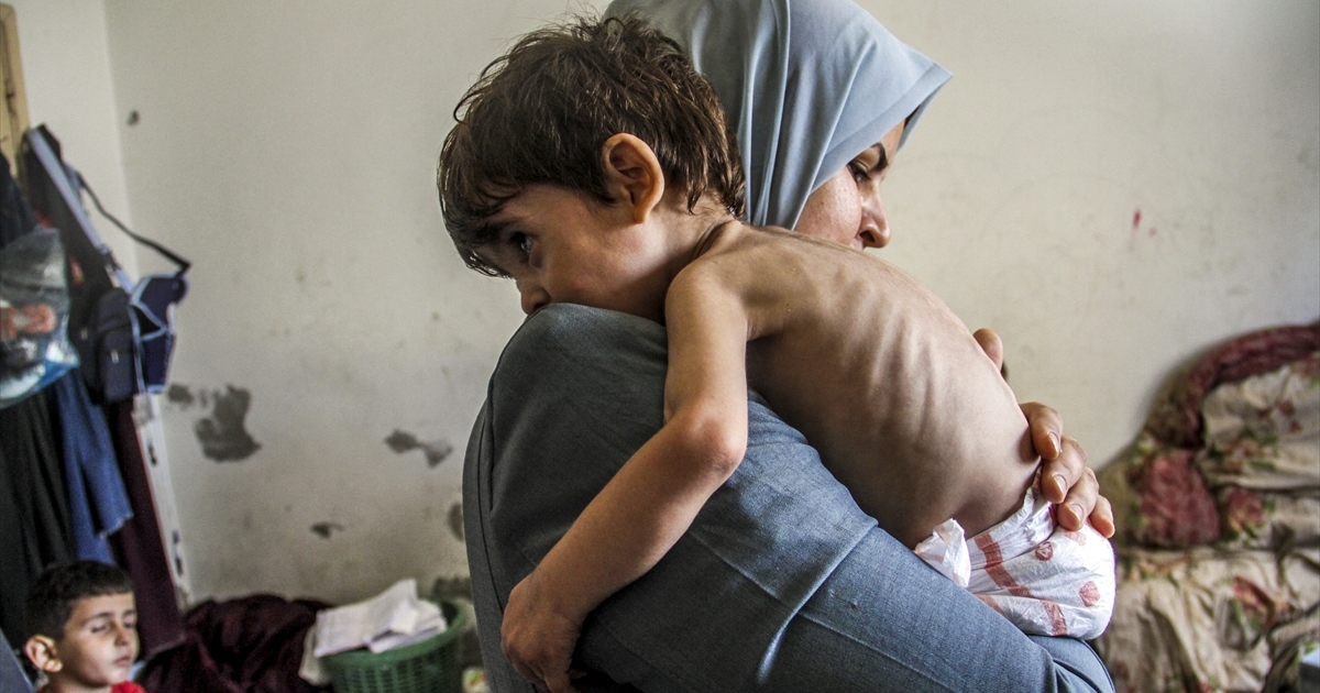 Gaza’s children face horror as death toll rises and rights vanish - News Karnataka