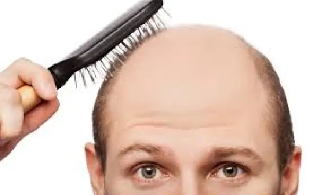 Man Counts Every Hair on His Head After Going Bald — Internet Can't Handle It - News Karnataka