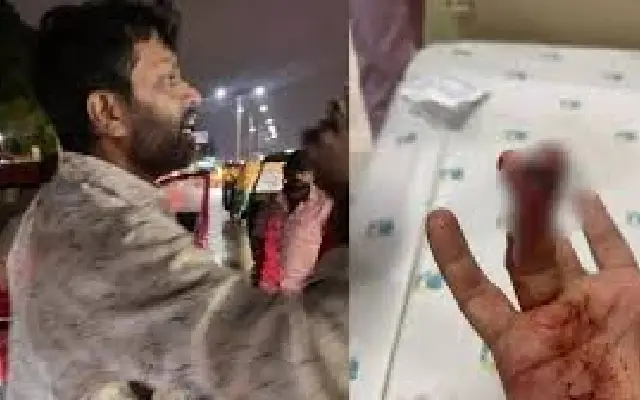 Bengaluru Road Rage Turns Brutal: Man Bites Motorist’s Finger Over Rainwater Splash - News Karnataka
