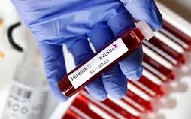 Karnataka Reports First Covid Death of 2025 as Mild Cases Rise — State Steps Up Vigil - News Karnataka