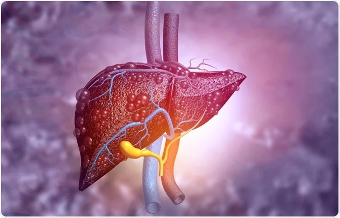 Liver diseases in children: a rising silent threat - News Karnataka