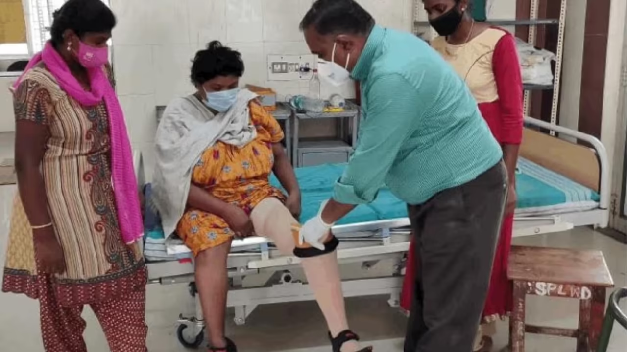 Back on his feet: CMCH prosthetic unit gives amputees a new lease on life - News Karnataka