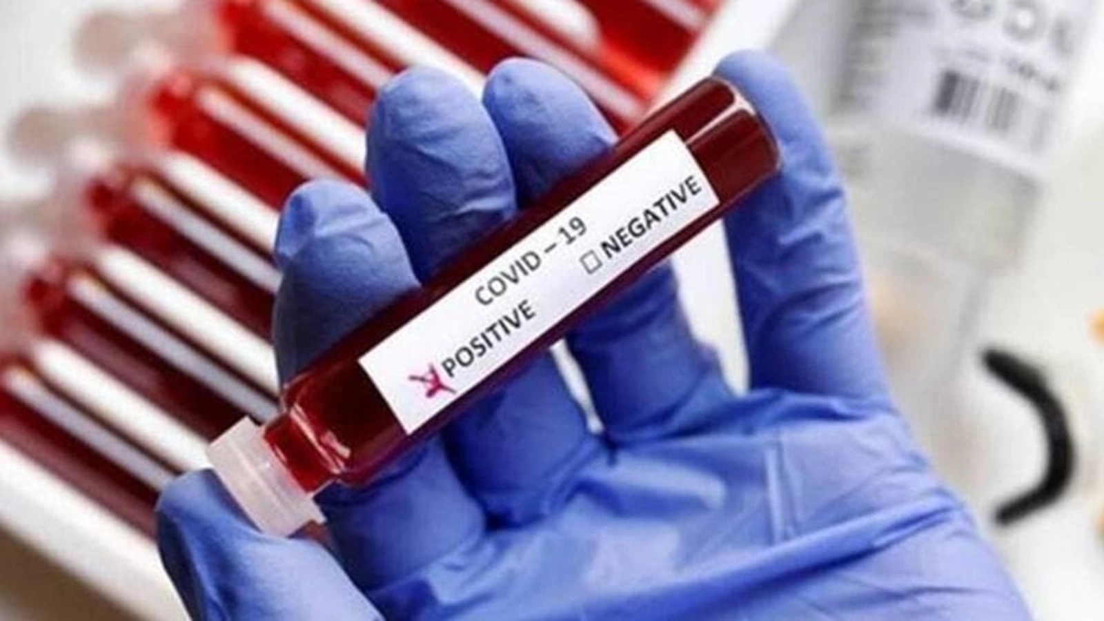 Davangere man tests positive for Covid after death; Karnataka toll rises to 7 - News Karnataka