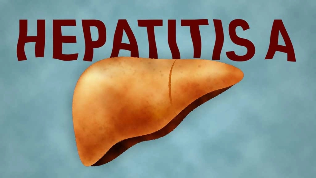 Jaundice scare grips Kochi as Hepatitis A spreads after family function - News Karnataka