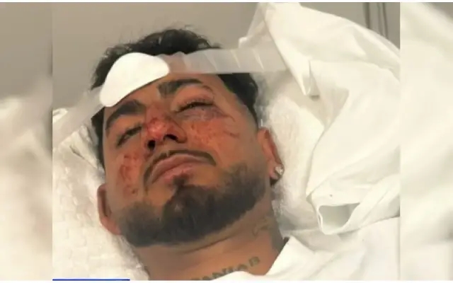 Indian Student Brutally Assaulted in Australia in Alleged Racial Attack - News Karnataka