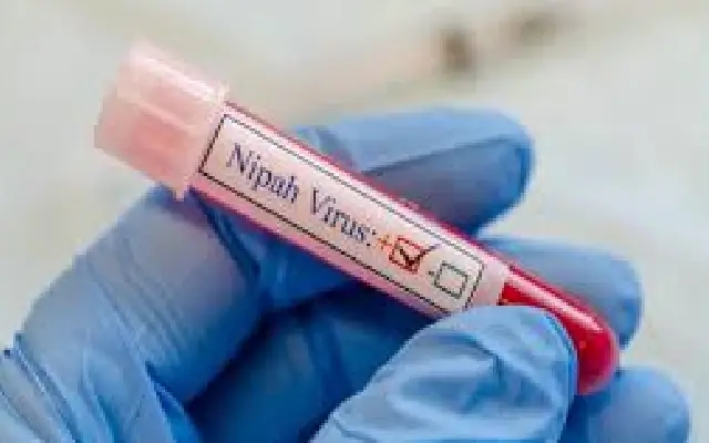Kerala ramps up surveillance after suspected Nipah death in Palakkad - News Karnataka