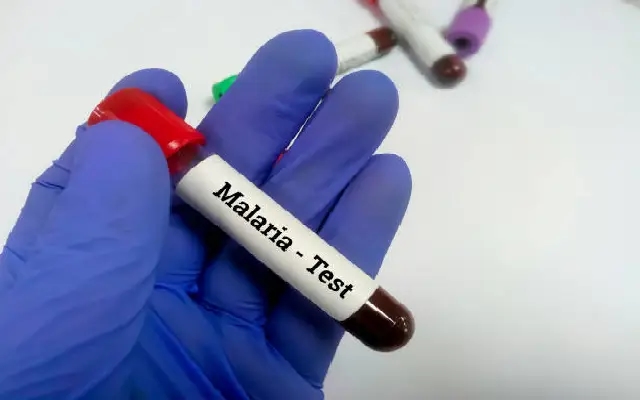 Rise in Malaria Cases in Dakshina Kannada, Migrant Workers Under Surveillance - News Karnataka