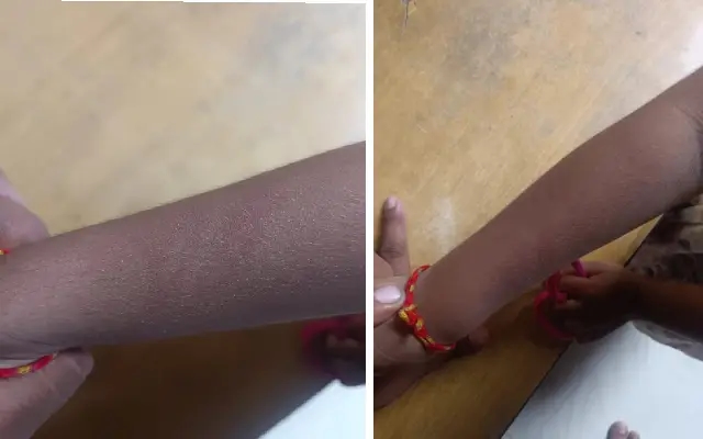 Principal Held for Assaulting Child Over ‘Radhe Radhe' Greeting at Mother Teresa English Medium School - News Karnataka
