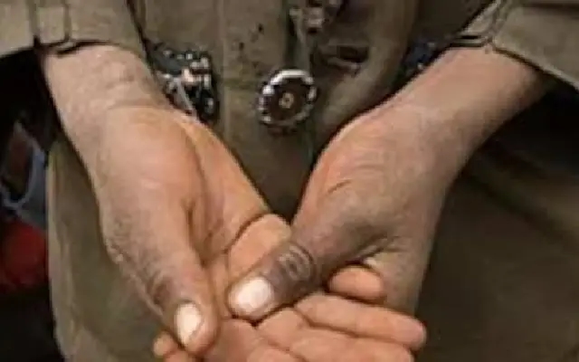 Teen Walks 150 km with Severed Arm to Escape Forced Labour - News Karnataka