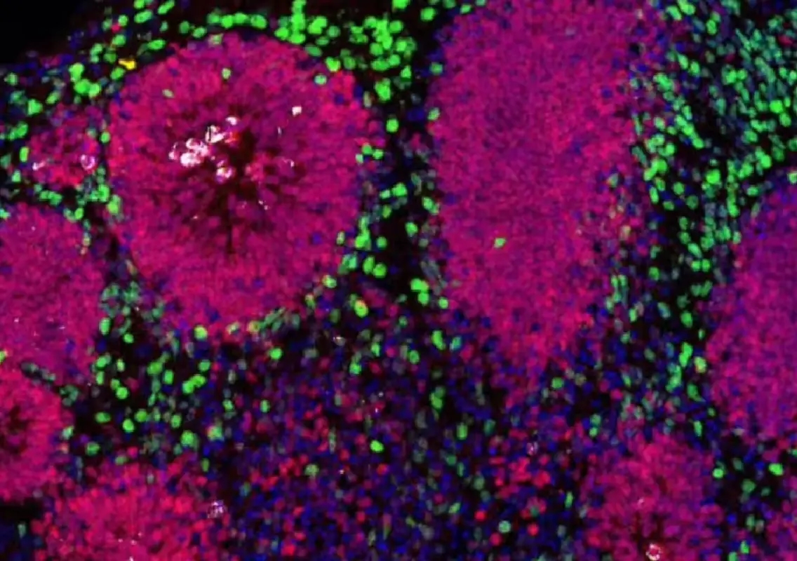 Bengaluru scientists uncover lipid link behind rare brain disorder Lowe Syndrome - News Karnataka