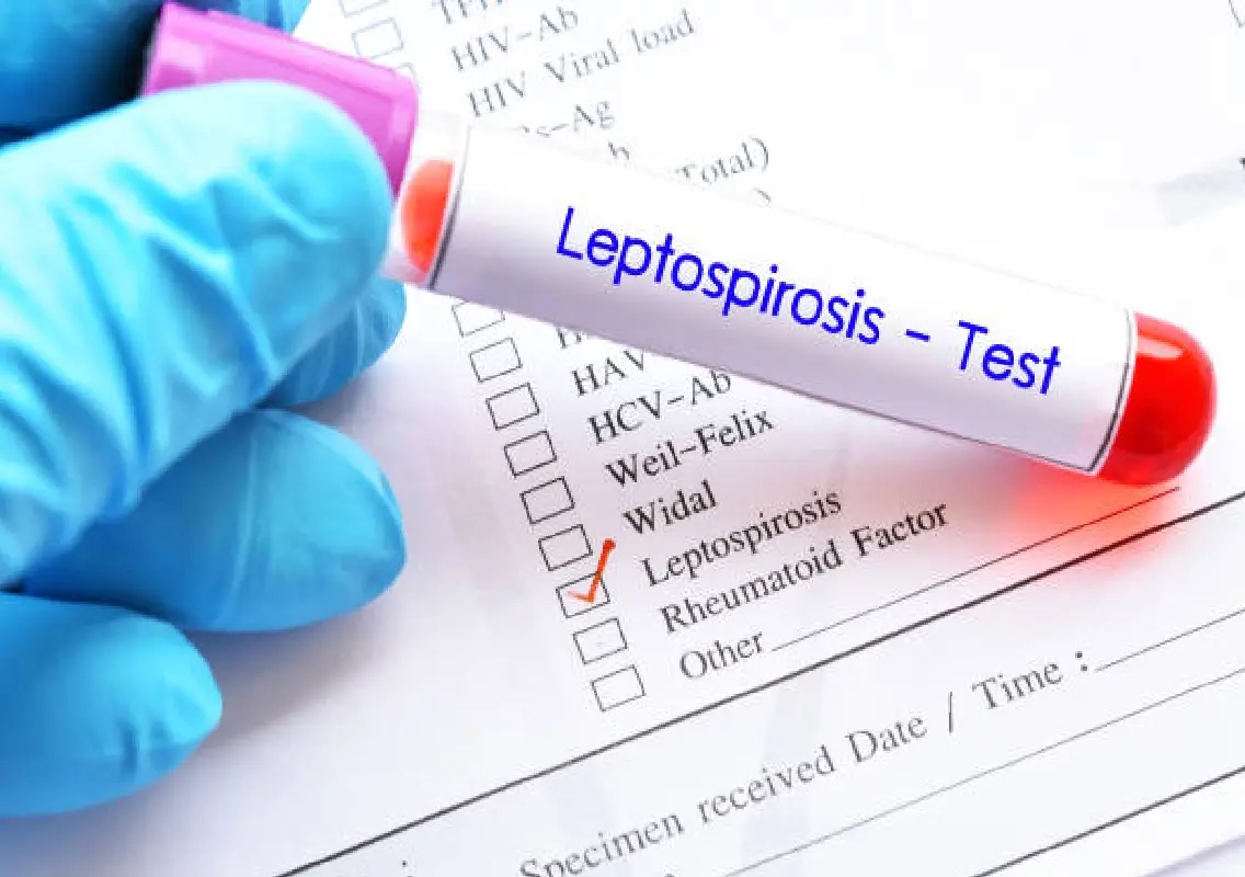 Leptospirosis cases rise to 2,042 in Karnataka by mid-November, say health officials - News Karnataka