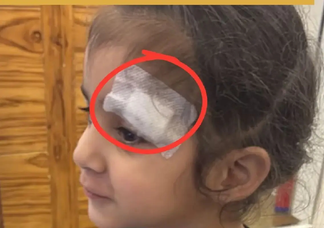 Meerut doctor accused of using Fevikwik on child’s wound, probe ordered - News Karnataka