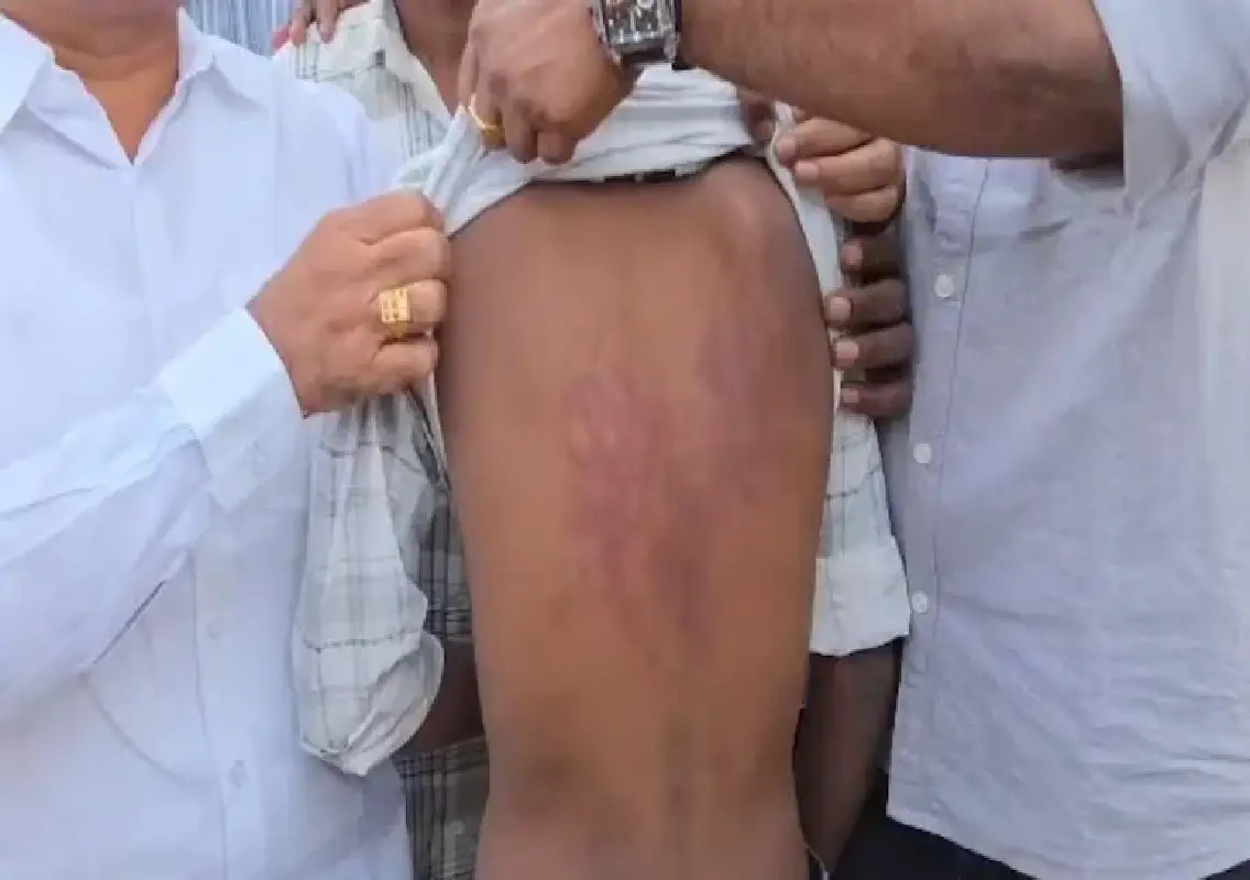 Hyderabad school principal orders seniors to thrash Class 7 student - News Karnataka