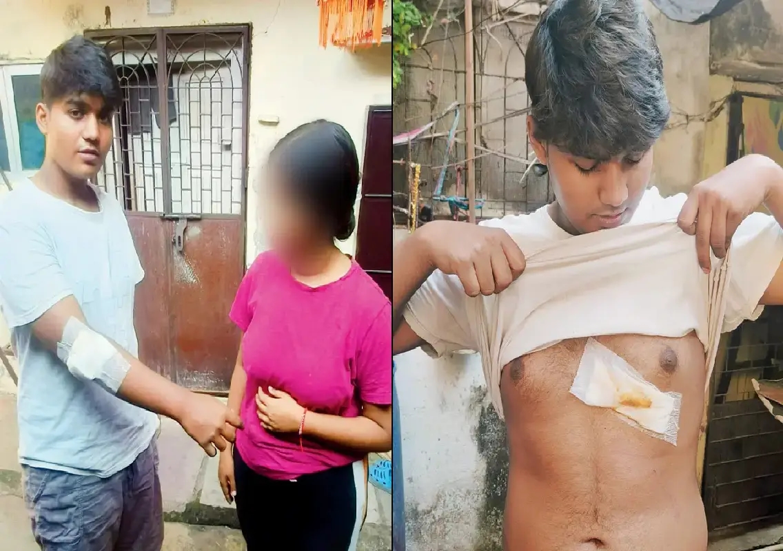 Mumbai youth saves friend as speeding police jeep hits them in Vile Parle - News Karnataka