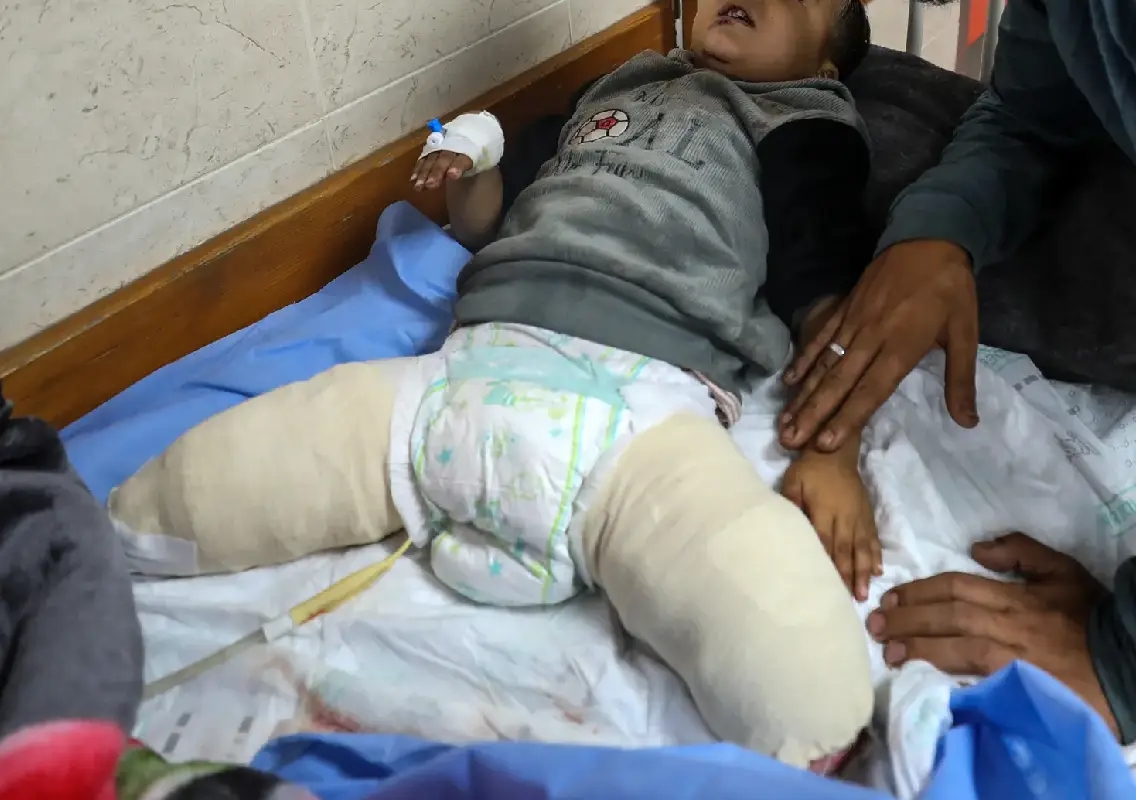 Gaza boy who lost leg struggles to heal amid war and winter - News Karnataka