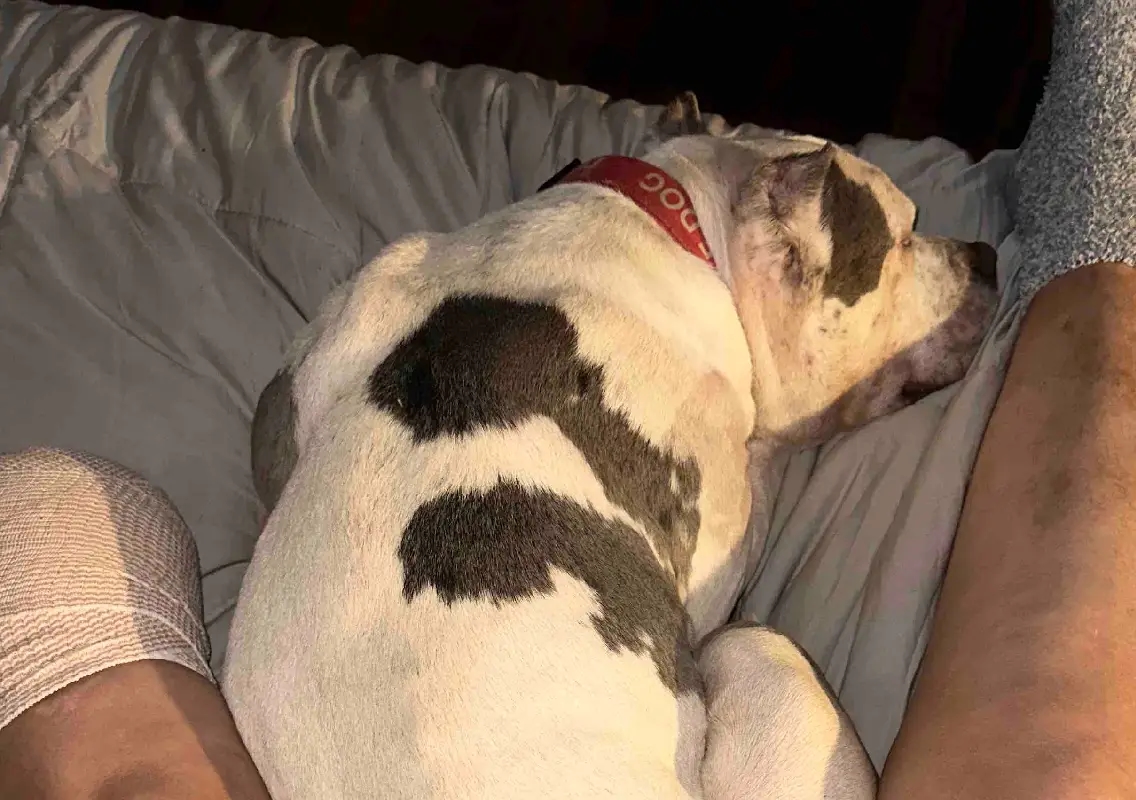 Tennessee dog attack leaves woman amputated, sparks safety debate - News Karnataka