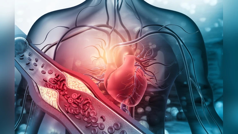 Why fit people can still suffer fatal heart attacks: doctors explain - News Karnataka