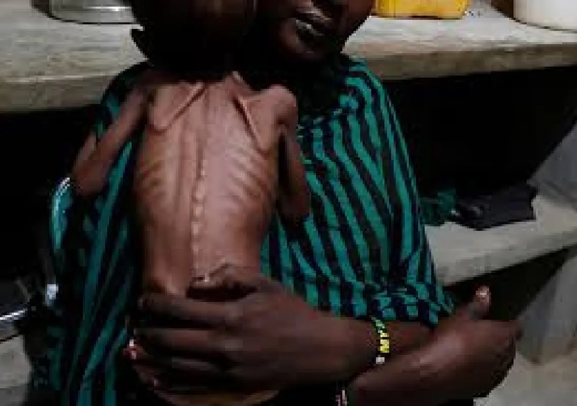 Child deaths rise in Sudan amid violence and hunger crisis - News Karnataka