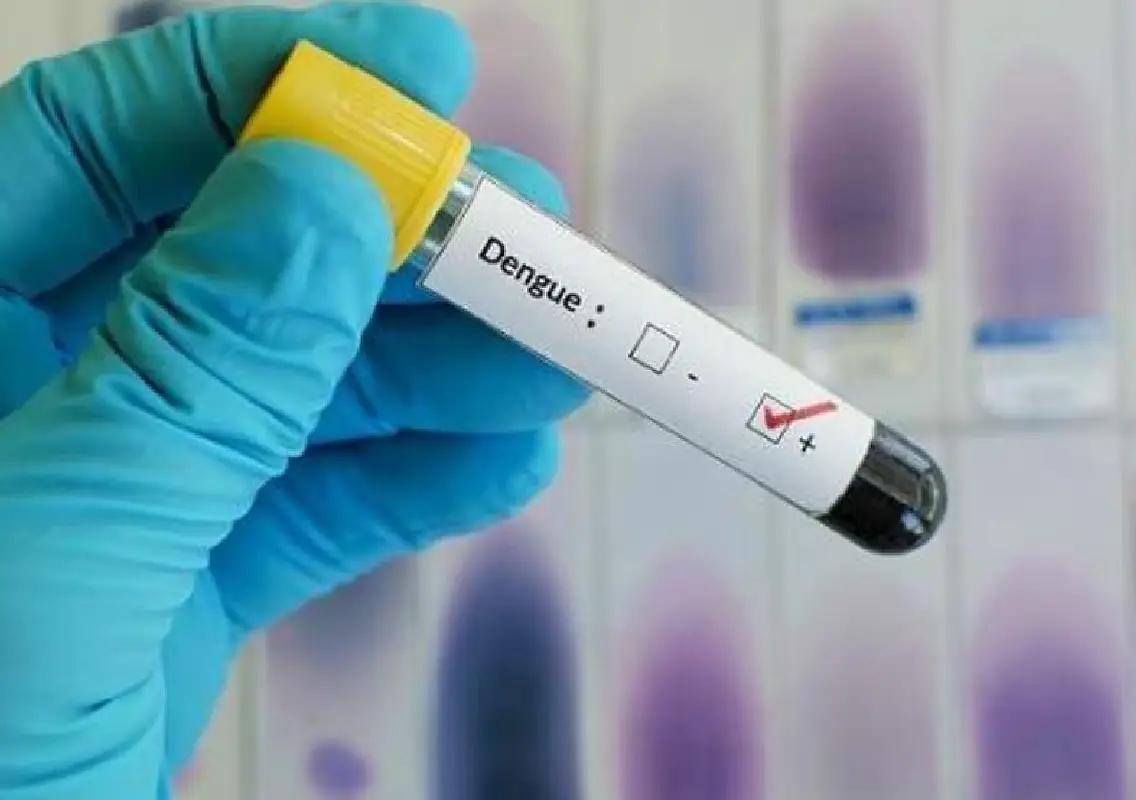 Class VI student dies of dengue despite treatment - News Karnataka