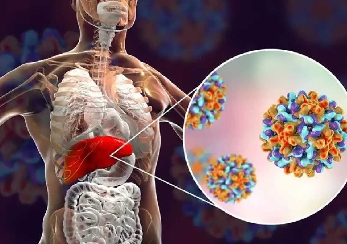 Experts warn hepatitis elimination goals still far from reality - News Karnataka