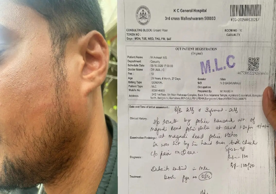 FIR registered against PSI at his own police station - News Karnataka