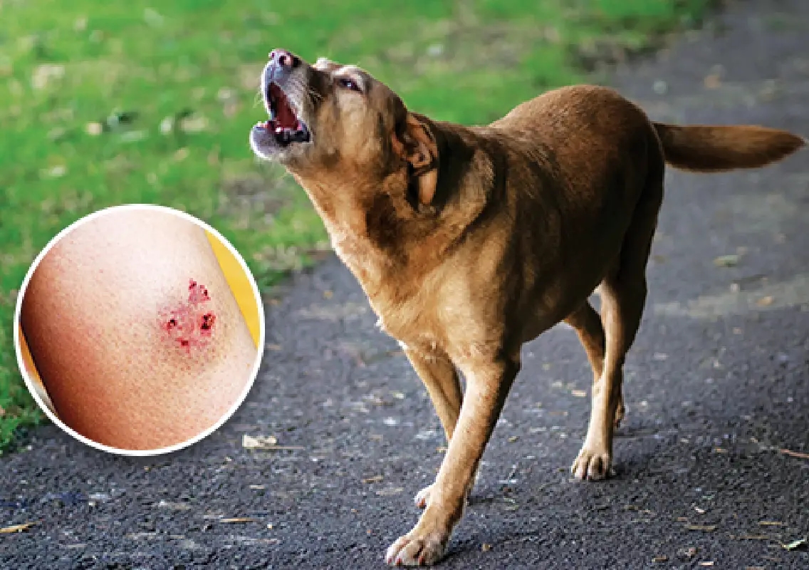 Pet dog bite turns fatal as man dies of rabies - News Karnataka