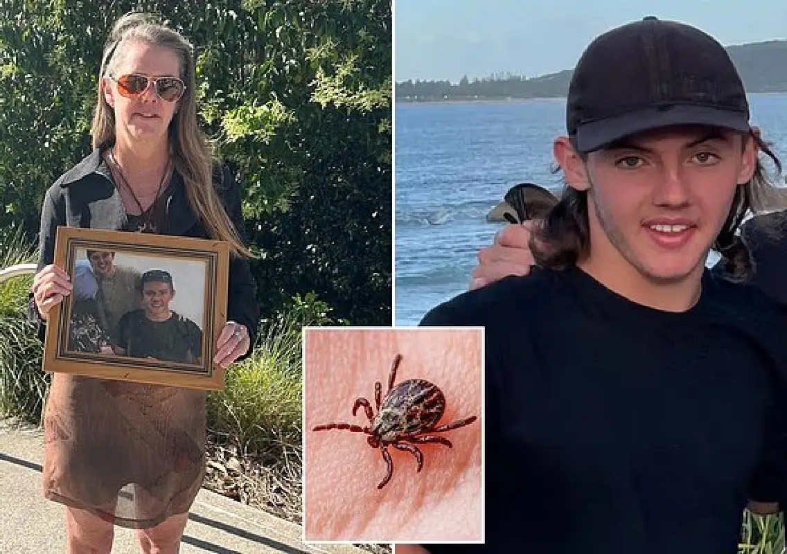 Teen’s tragic death exposes rare tick-linked meat allergy - News Karnataka