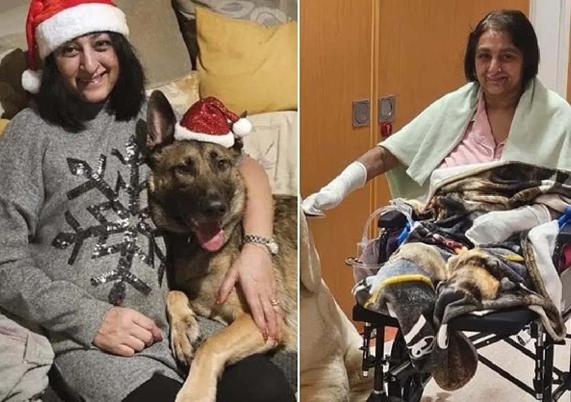 UK woman loses limbs after suspected infection from dog lick - News Karnataka