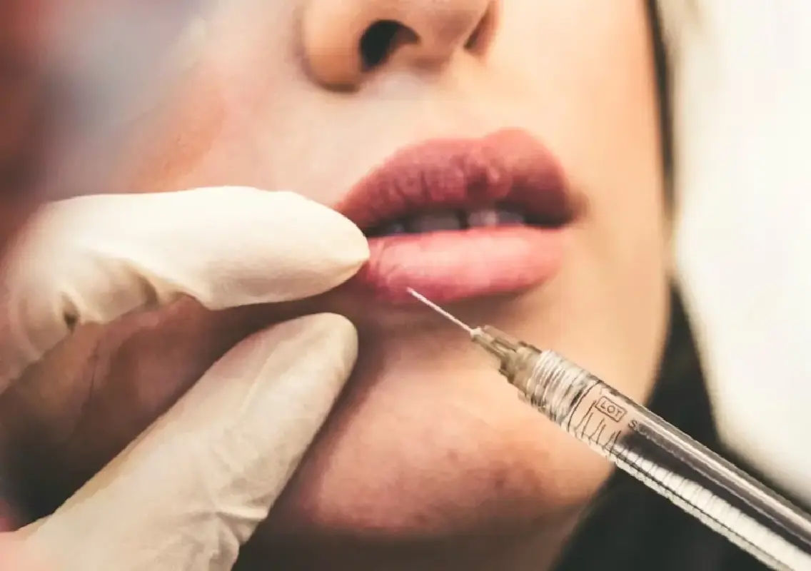 US cosmetic trend using cadaver fat sparks safety and ethics debate - News Karnataka